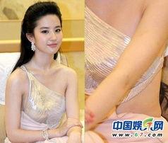 女明星肚子赘肉,赘肉与美丽并存